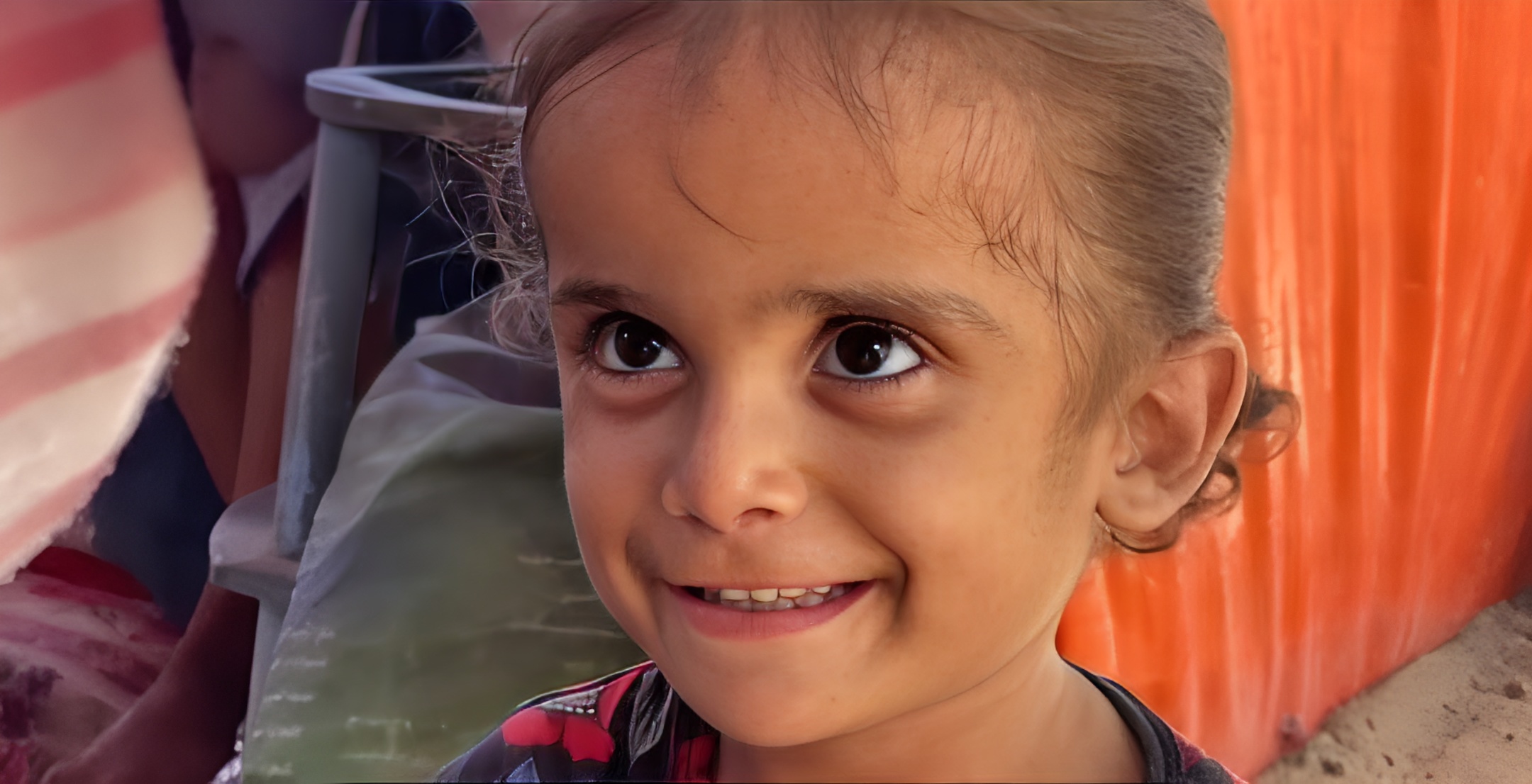 A child's battle against malnutrition/ Gazas silent crisis